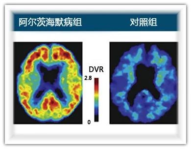 讲真，人类确实离不开辐射
