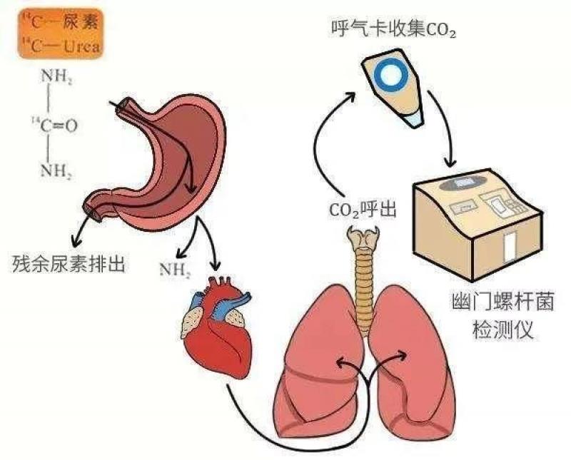 幽门螺杆菌检测与商用核反应堆居然有关联？