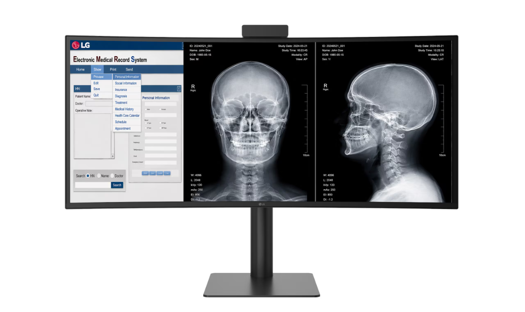 LG Electronics lance un moniteur de diagnostic 40 pouces approuvé par la FDA, destiné au marché de l'imagerie médicale B2B
