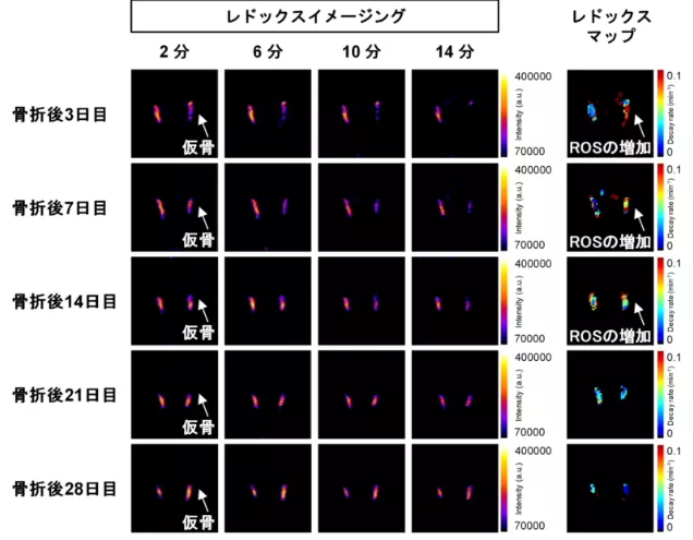日本研究团队利用超极化磁共振成像可视化骨折愈合细胞代谢变化